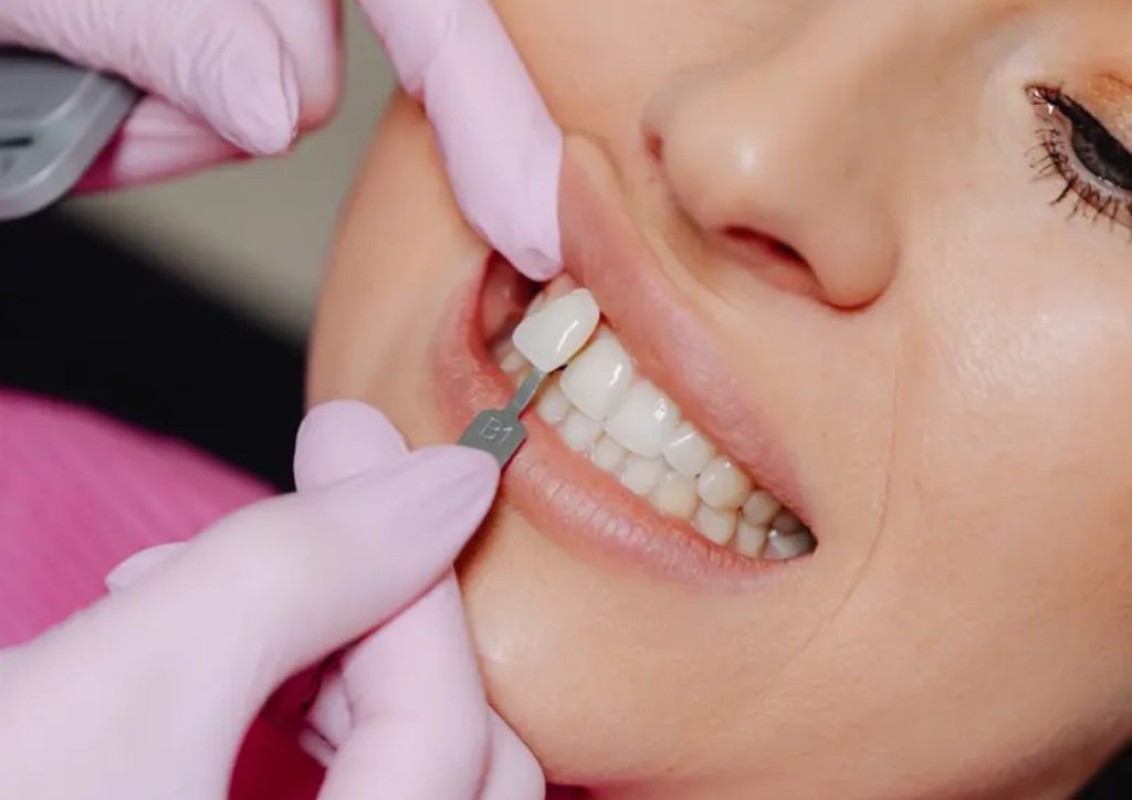 Who Might Need a Full Set of Dental Implants?